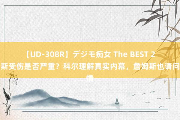 【UD-308R】デジモ痴女 The BEST 2 詹姆斯受伤是否严重？科尔理解真实内幕，詹姆斯也请问伤情